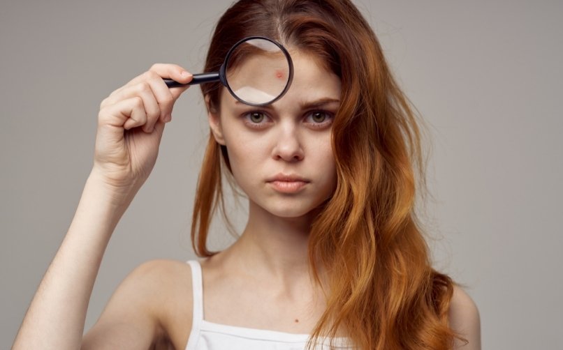 14-17 Yaşında Çocuklarda Saç Dökülmesi