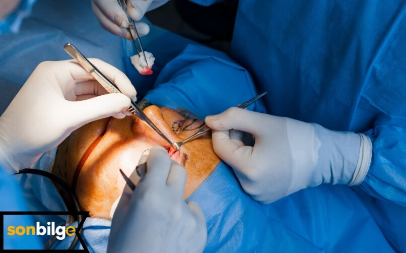 Göz Kapağı Düşüklüğü Ameliyatı Nasıl Yapılır?