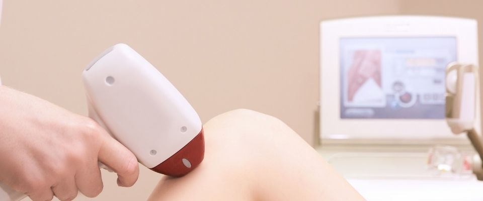 En iyi lazer epilasyon cihazı