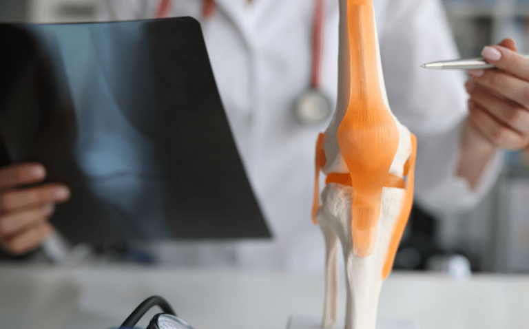 Türkiye’nin En İyi Romatoloji Doktorları (2025 Güncel Liste + Detaylı Rehber)